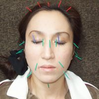 青木治療院が選ばれる理由03